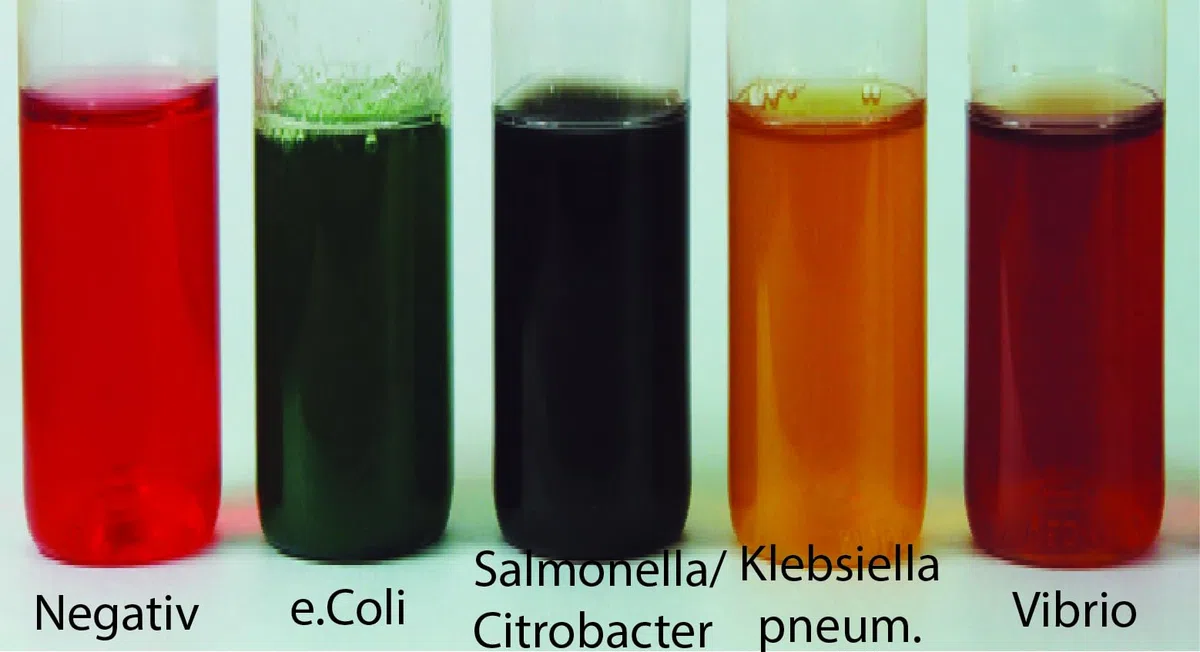 Test batterico rapido 4-6 ore dell'acqua 5 in 1 per e.Coli, Salmonella, Citrobacter, Klebsiella e Vibrios Test dei batteri nell'acqua potabile e nell'acqua di pozzo (2)